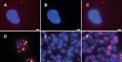 Detection of HPV and Human Chromosome Sites by Dual-Color Fluorescence In Situ Hybridization Reveals Recurrent HPV Integration Sites and Heterogeneity in Cervical Cancer